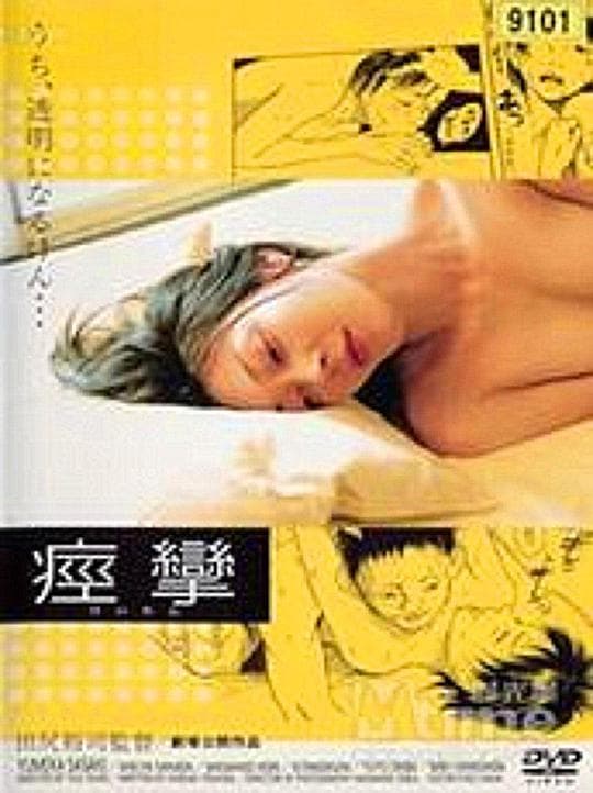 痉挛