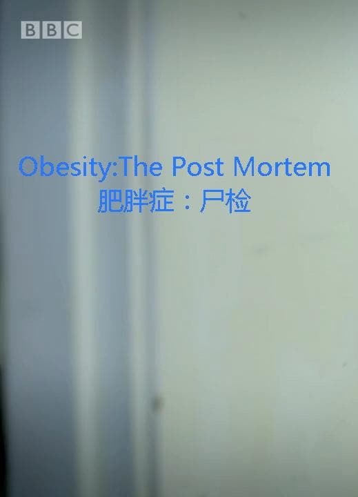 解剖肥胖